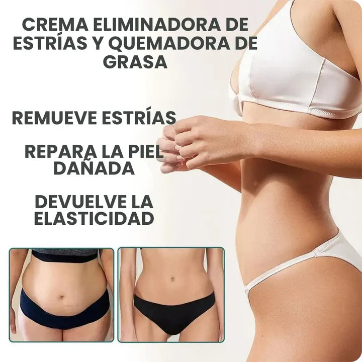 SKINREPAIR BURNING CREAM™ Crema Antiestrías